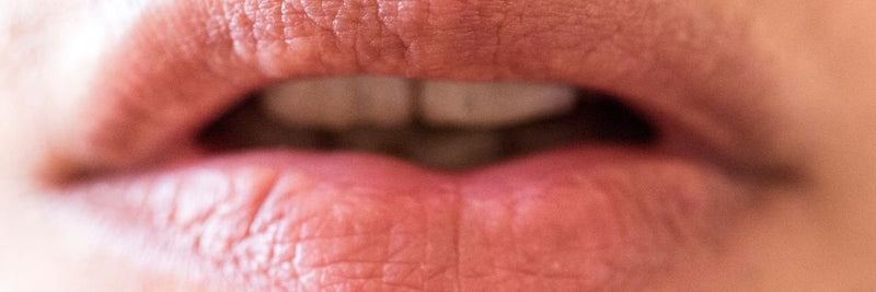 How to Heal Cheilitis, Dermatitis, and Other Common Lip Conditions - Osmia