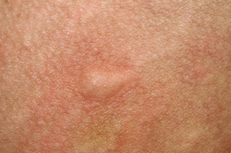 Skin Allergy vs. Skin Reaction: How to Tell the Difference - Osmia